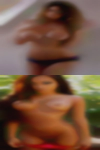 Woman nude girls in leg cast.